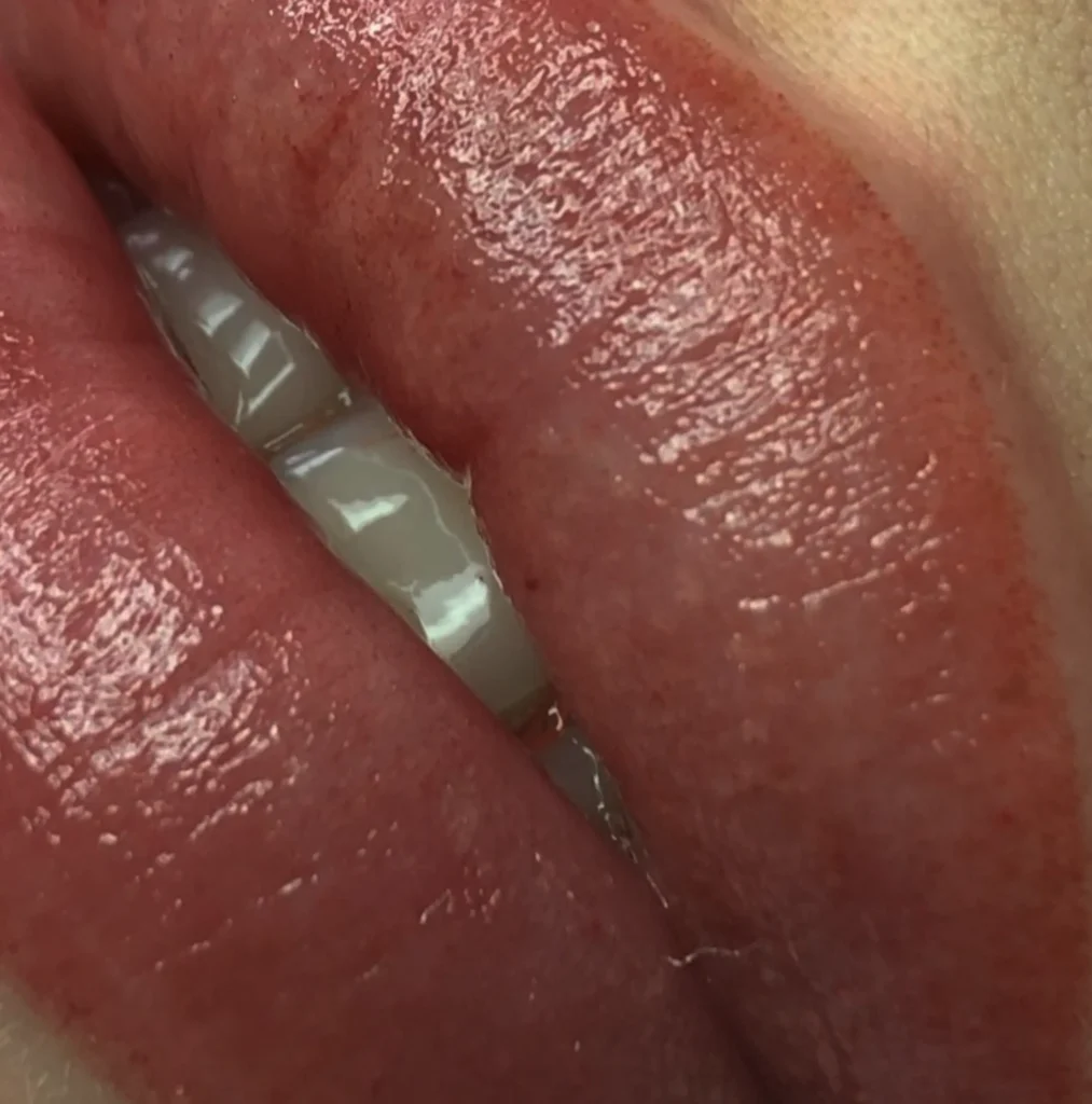 cosmetic lip tattoo cost